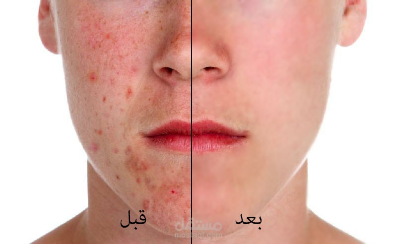 تعديل الصور