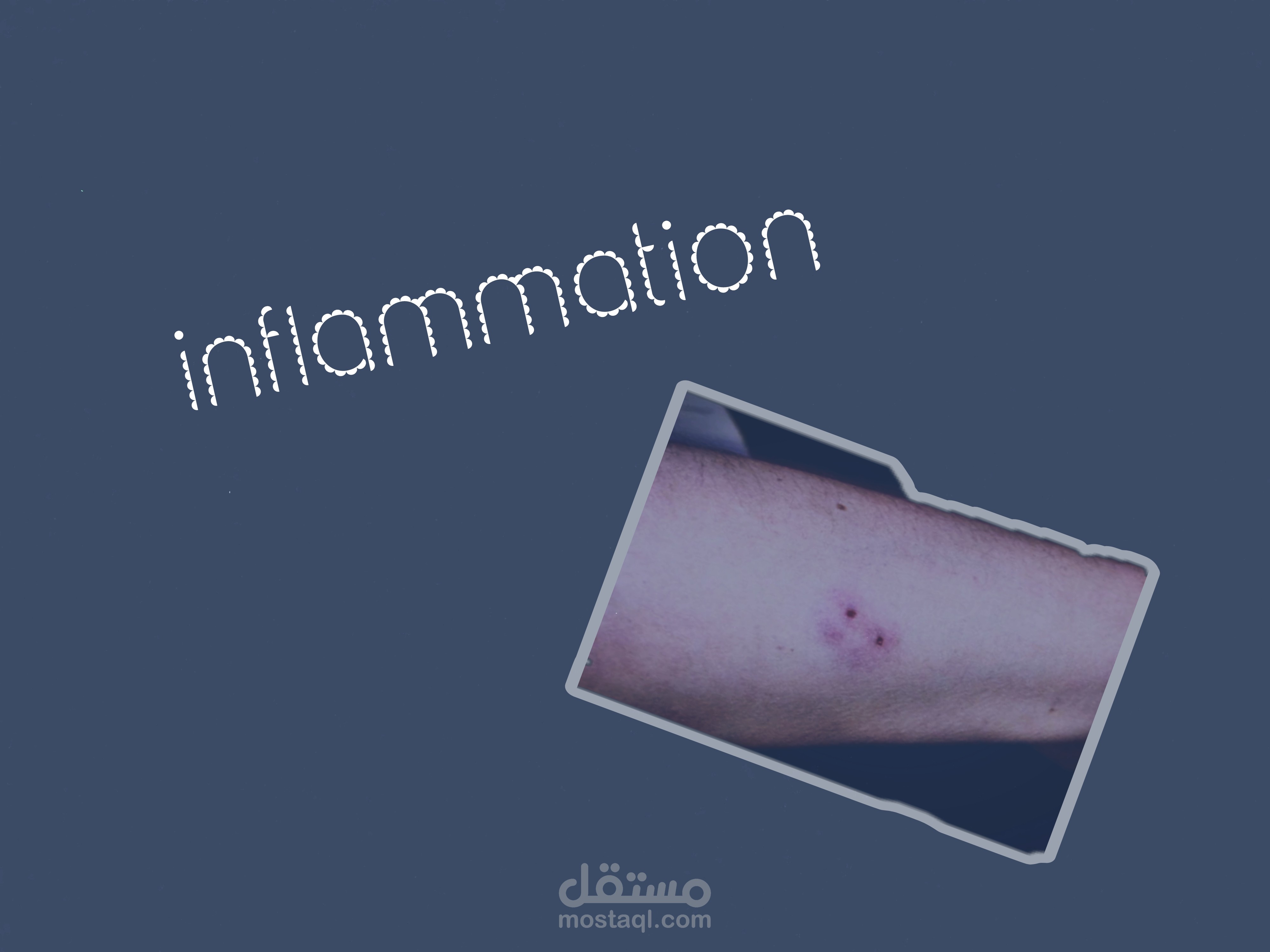 Inflammation/pathology summary in points as scientific term