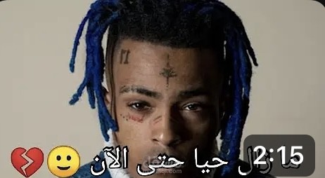 حقيقة وفاة المغني الاميركي xxxtentacion