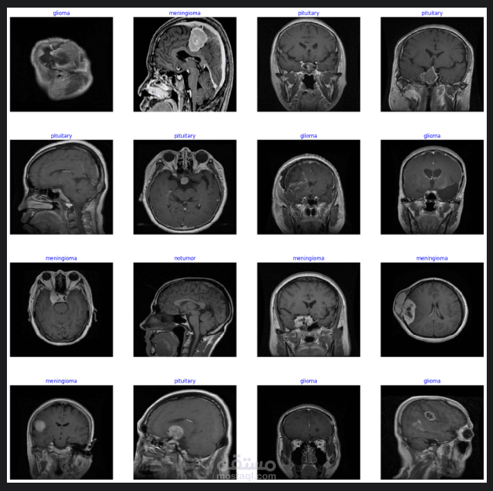 تمييز بين أورام المخ المختلفة و اذا هناك ورم ام لا من خلال صور MRI