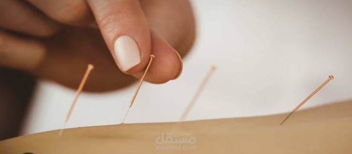 مقال تفاعلي عن الإبر الصينية