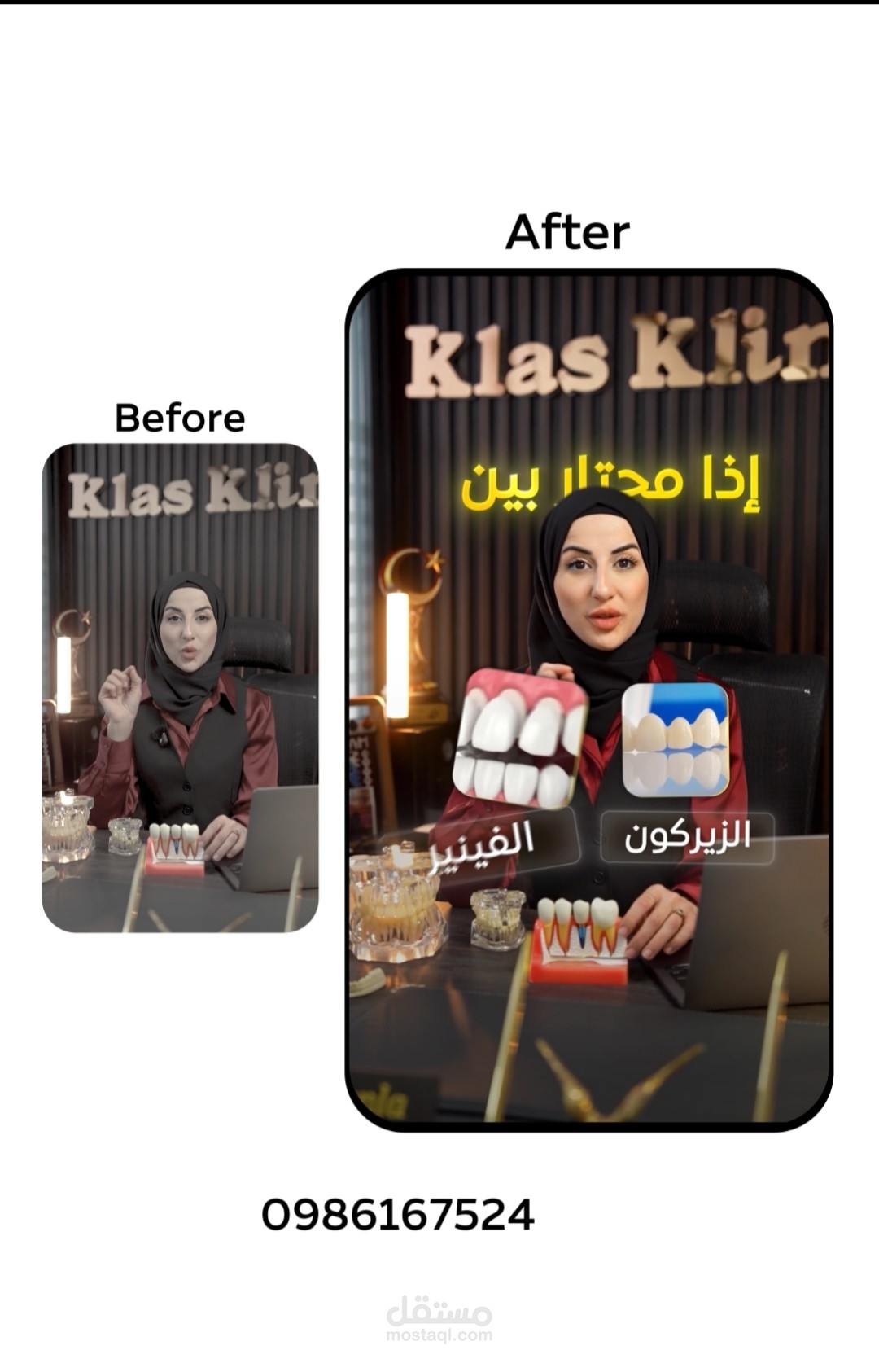 مونتاج طب أسنان بأسلوب عصري