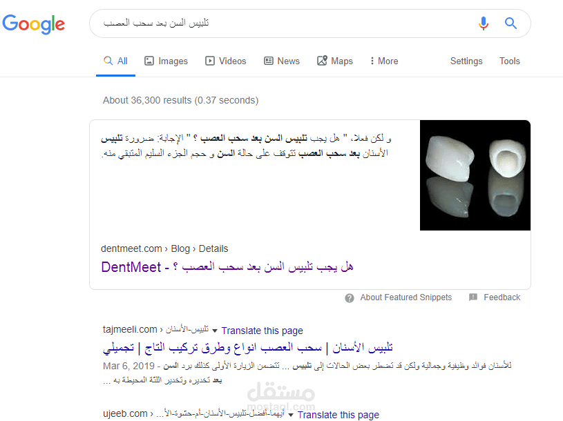 الظهور في المركز الأول في نتائج البحث على موضوع تلبيس السّن بعد حشو العصب