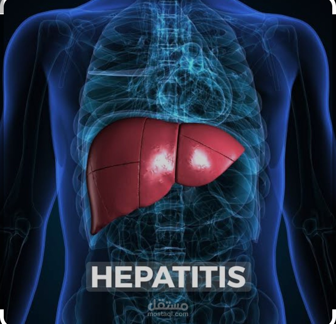 بحث عن مرض التهاب الكبد الوبائي وانواعه (Hepatitis)