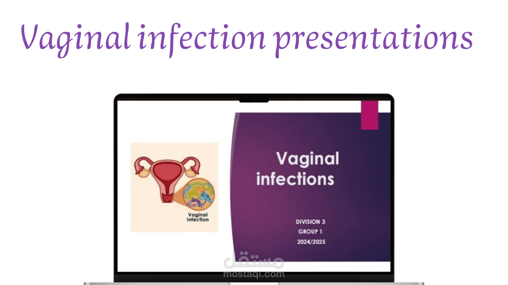 تصميم عرض تقديمي طبي (PowerPoint) احترافي عن العدوى المهبلية (Vaginal Infection)