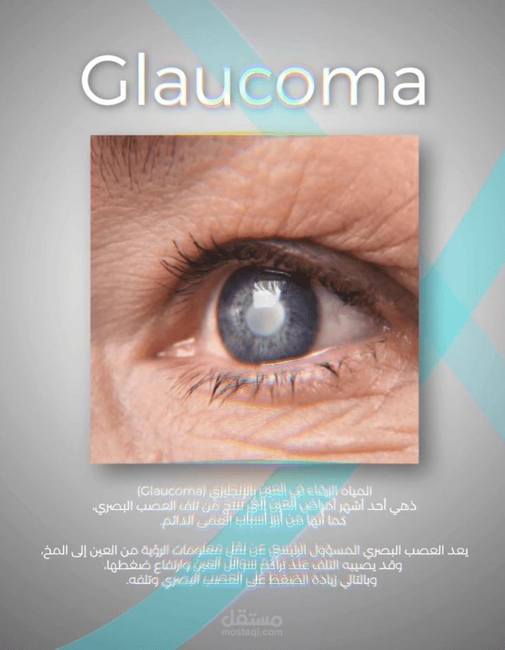 مونتاج Reel طبي عن فحص النظر - عوينات الخليج العربي