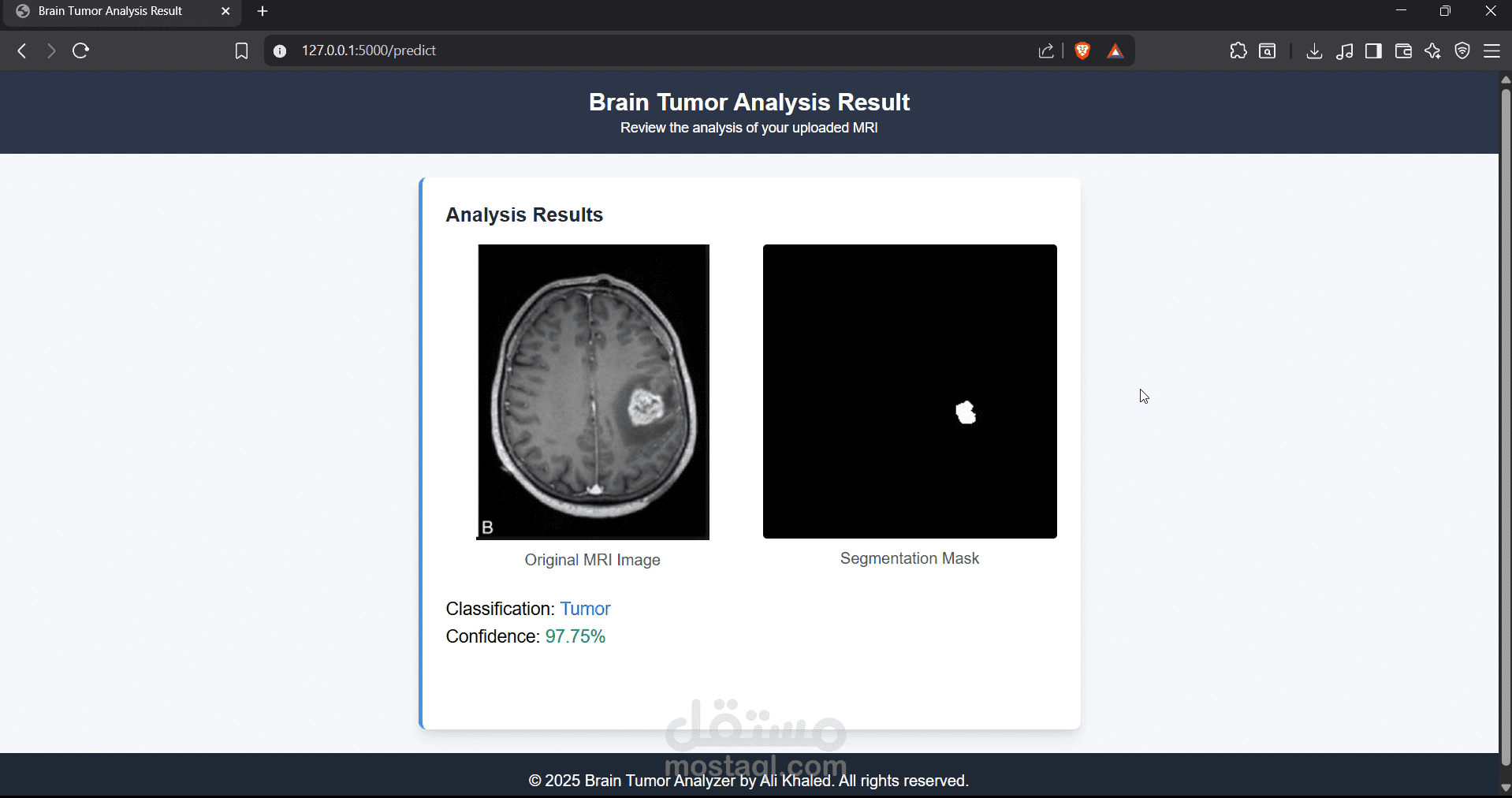 Brain Tumor Detection & Segmentation WebApp