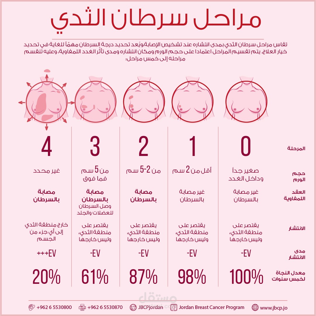 5 أسئلة عن سرطان الثدي يجب عليك معرفة أجابتهم