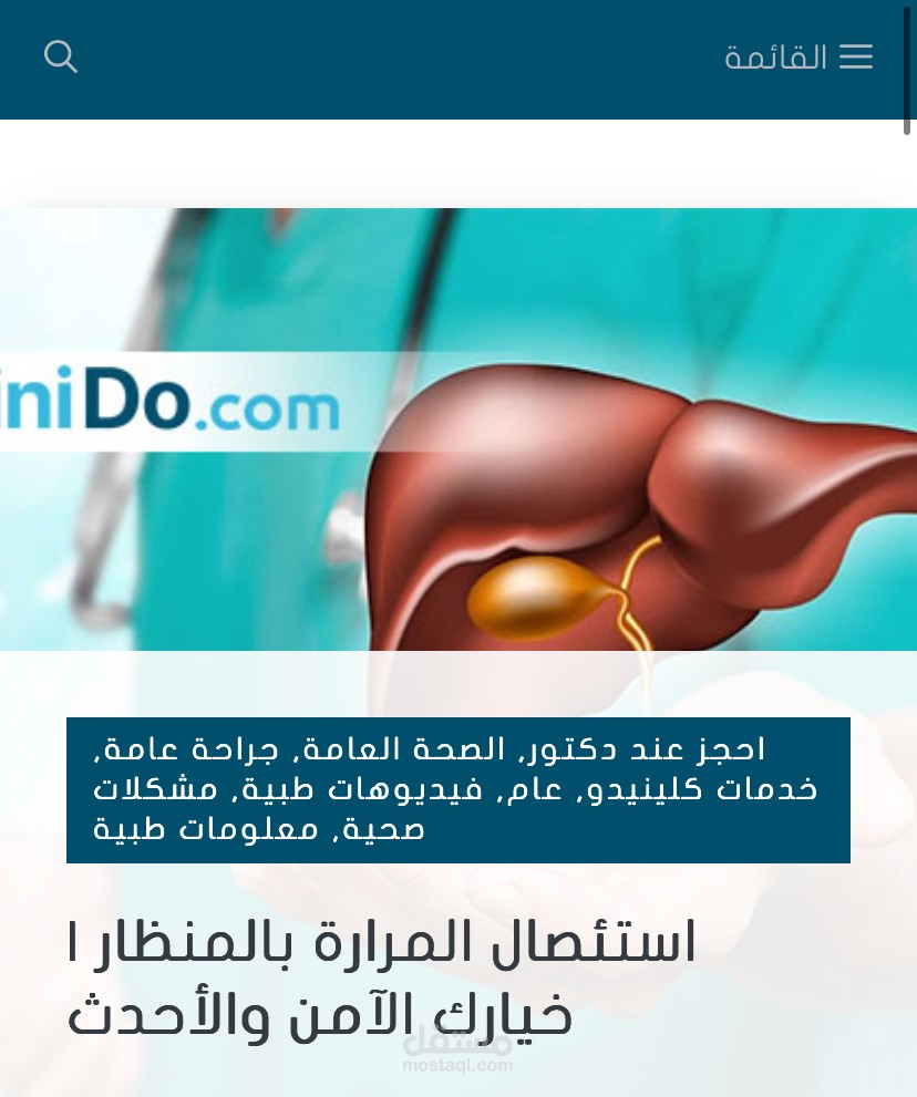 استئصال المرارة بالمنظار