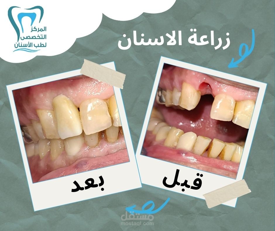 تصميم جرافيك