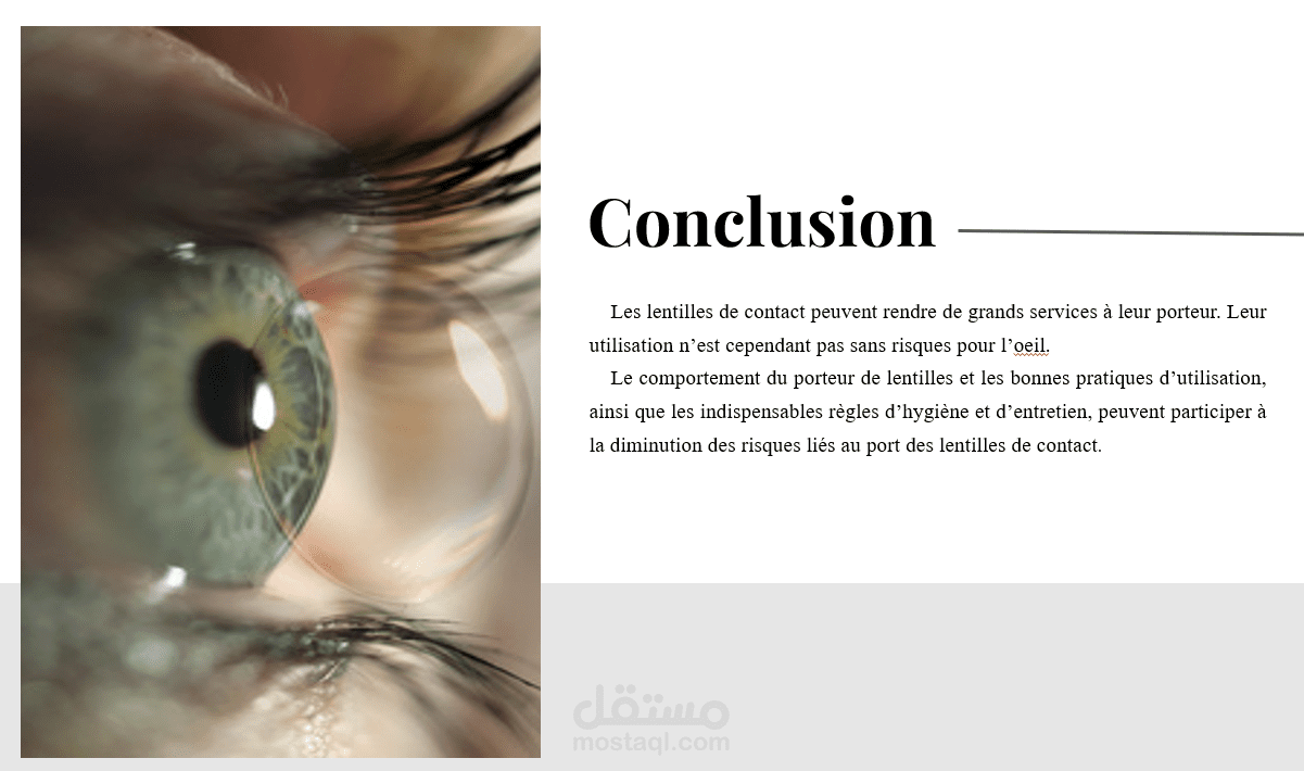 عرض PowerPoint عن مضاعفات ارتداء العدسات اللاصقة
