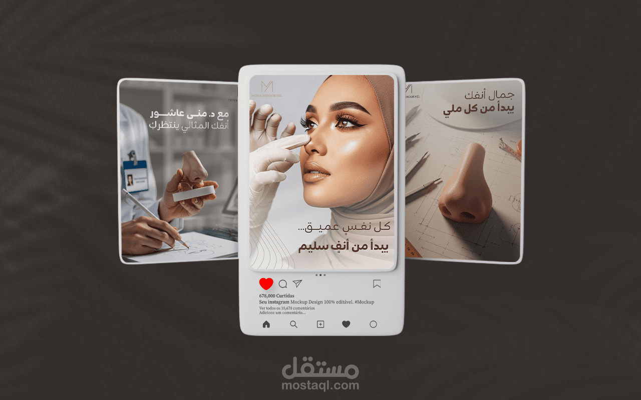 تصميمات سوشيال ميديا (تجميل الانف)