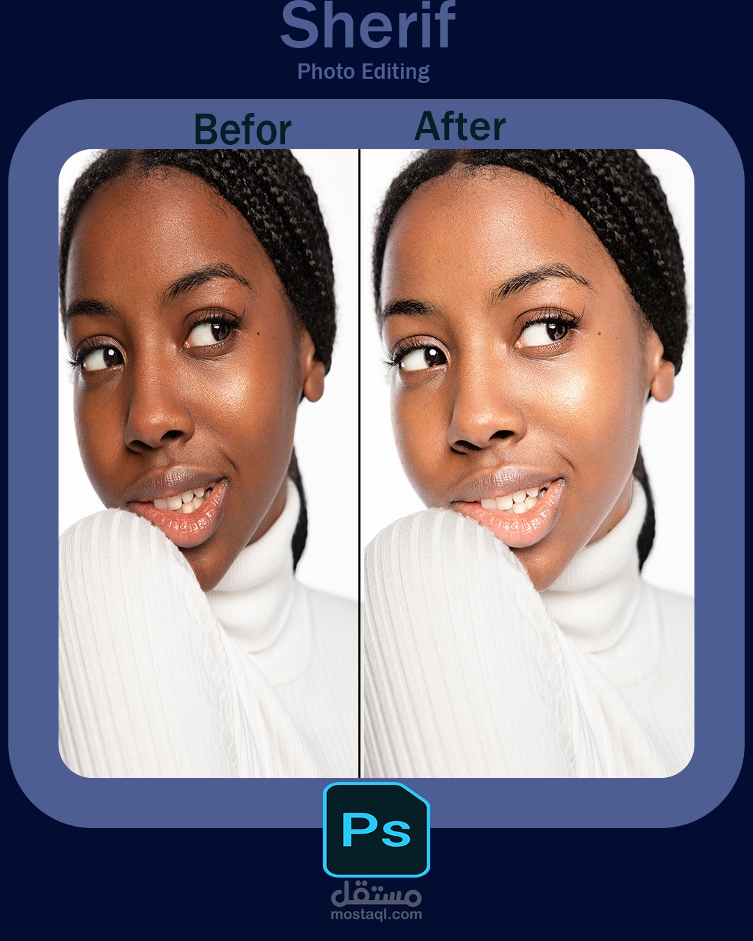 تبييض وتفتيح البشرة