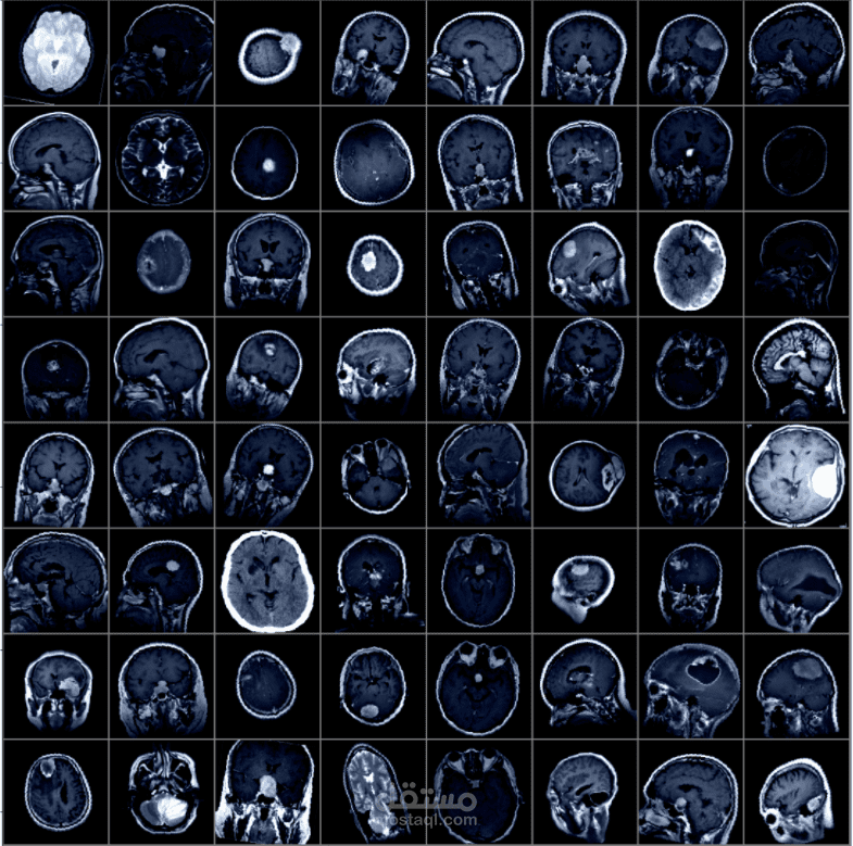 Brain Tumor Detection Using PyTorch