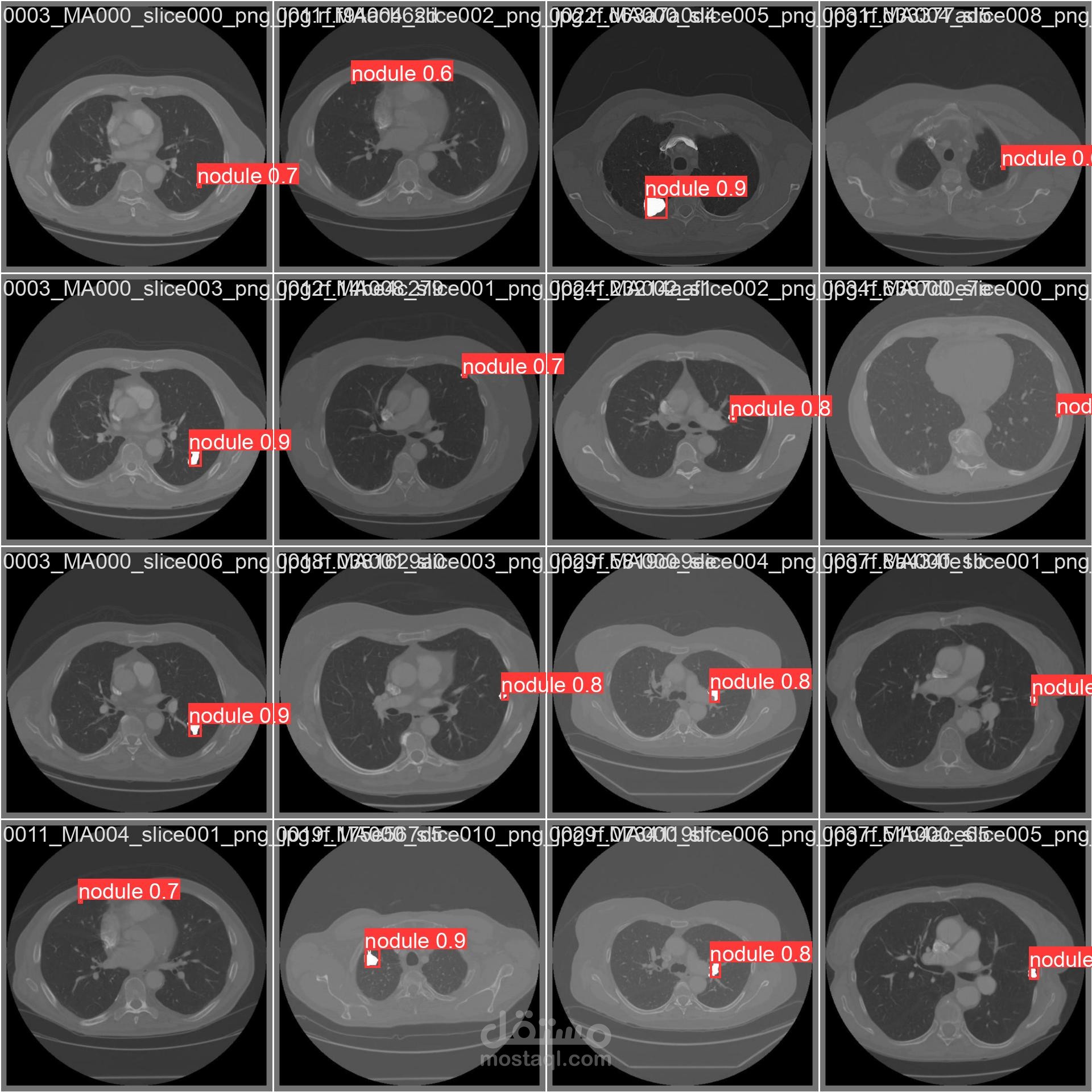 Enhanced detection of lung cancer using yolov9