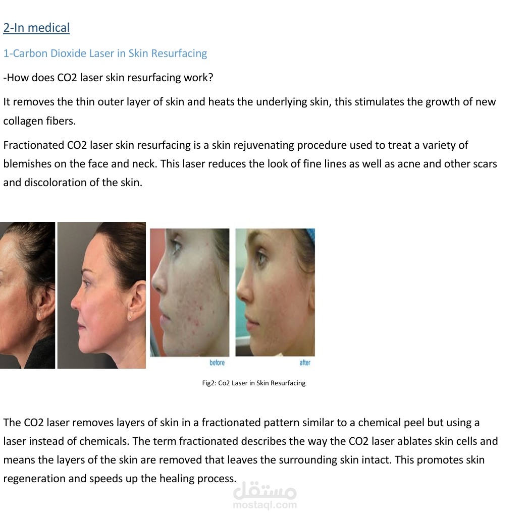 CO2 Laser Applications