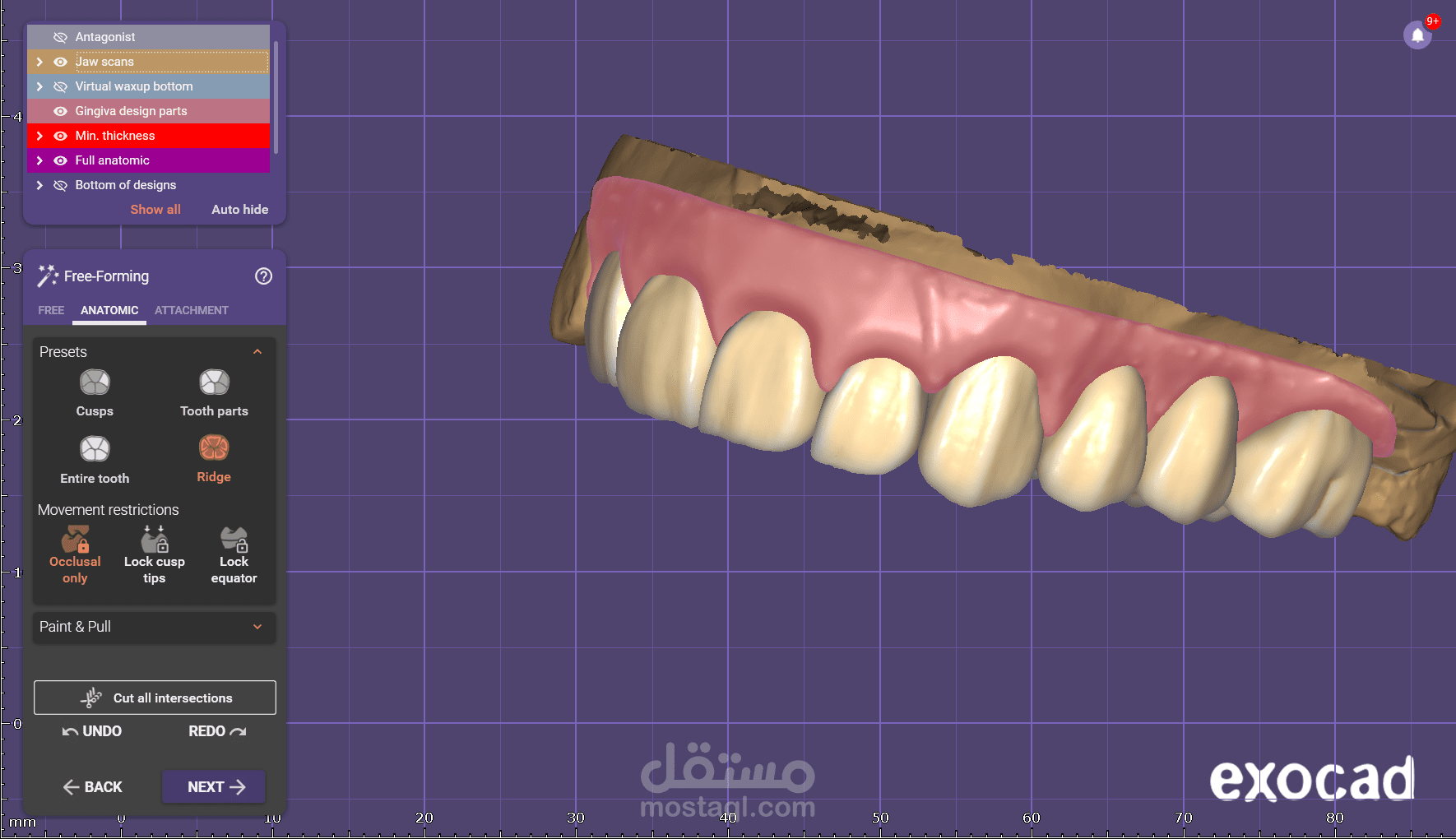 تصميم للأسنان الامامية والخلفية