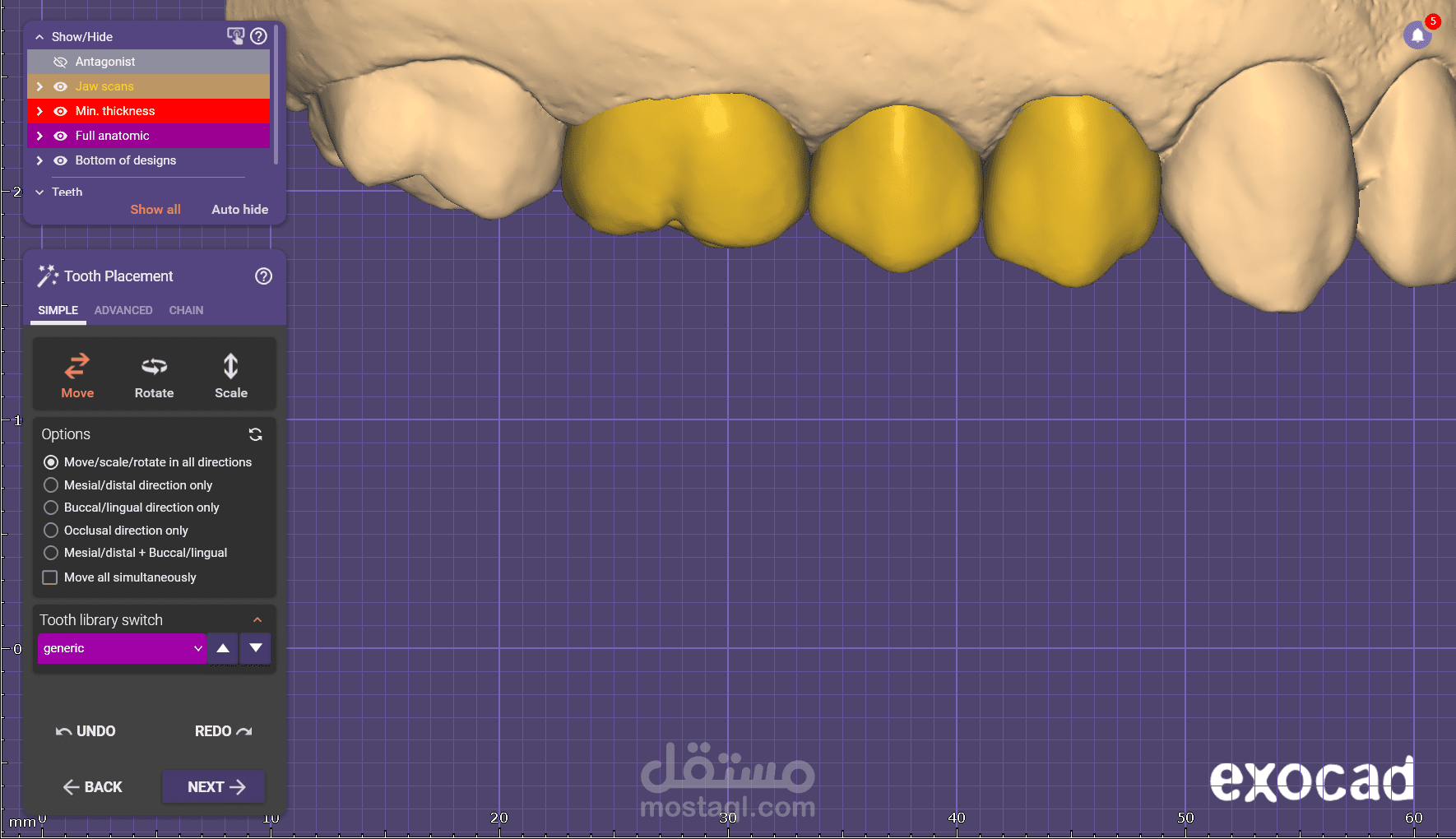 تصميم للأسنان الامامية والخلفية