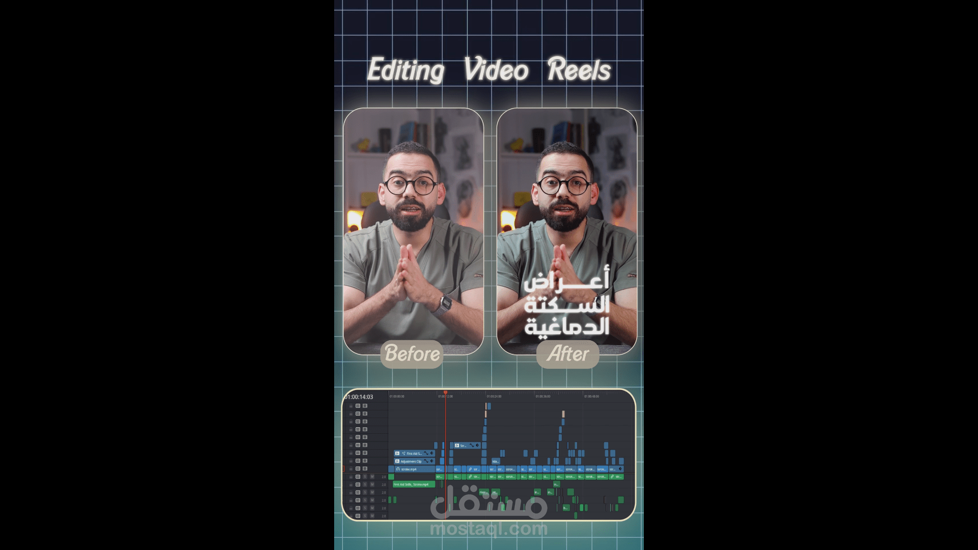 reel editing (The medical field)