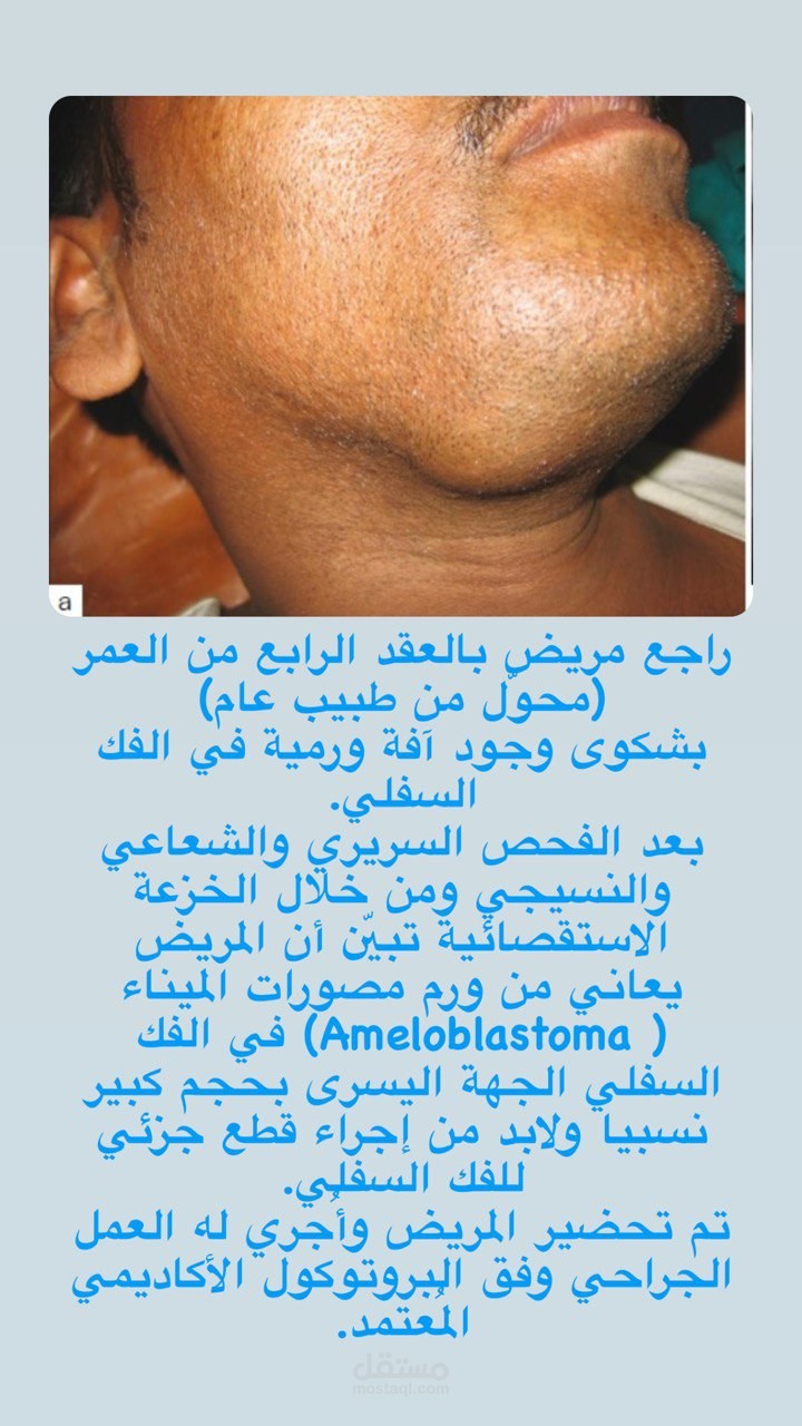 دراسة حالة سريرية في طب الاسنان
