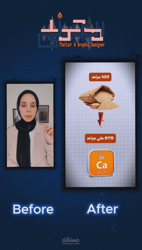 فيديو طبي عن نقص الكالسيوم | قبل وبعد