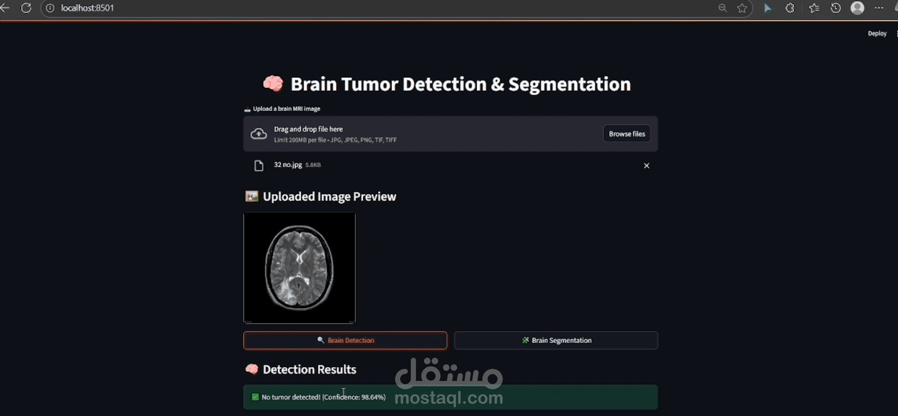 نظام ذكاء اصطناعي لتشخيص وتحديد أورام الدماغ من صور الرنين المغناطيسي (MRI)