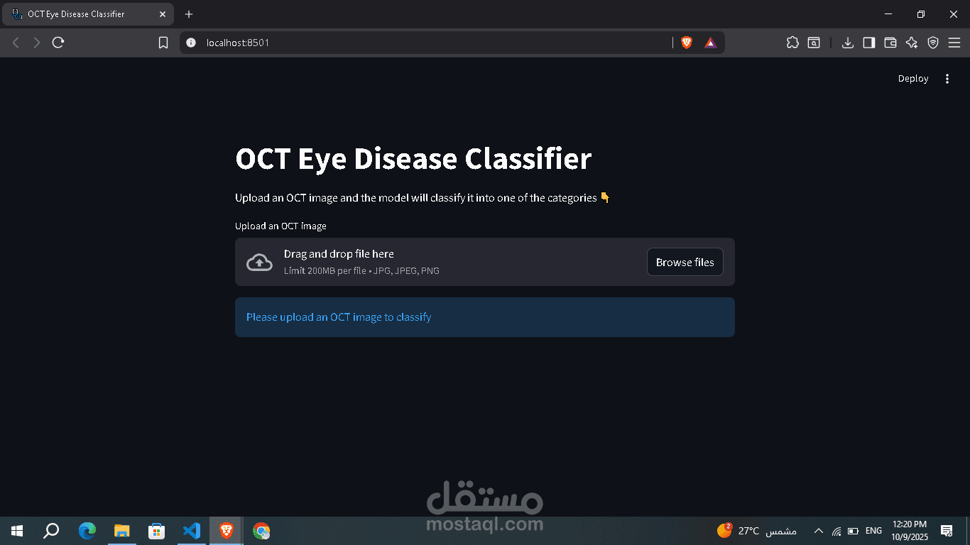 تصنيف أمراض الشبكية باستخدام صور OCT بالاعتماد على التعلم العميق