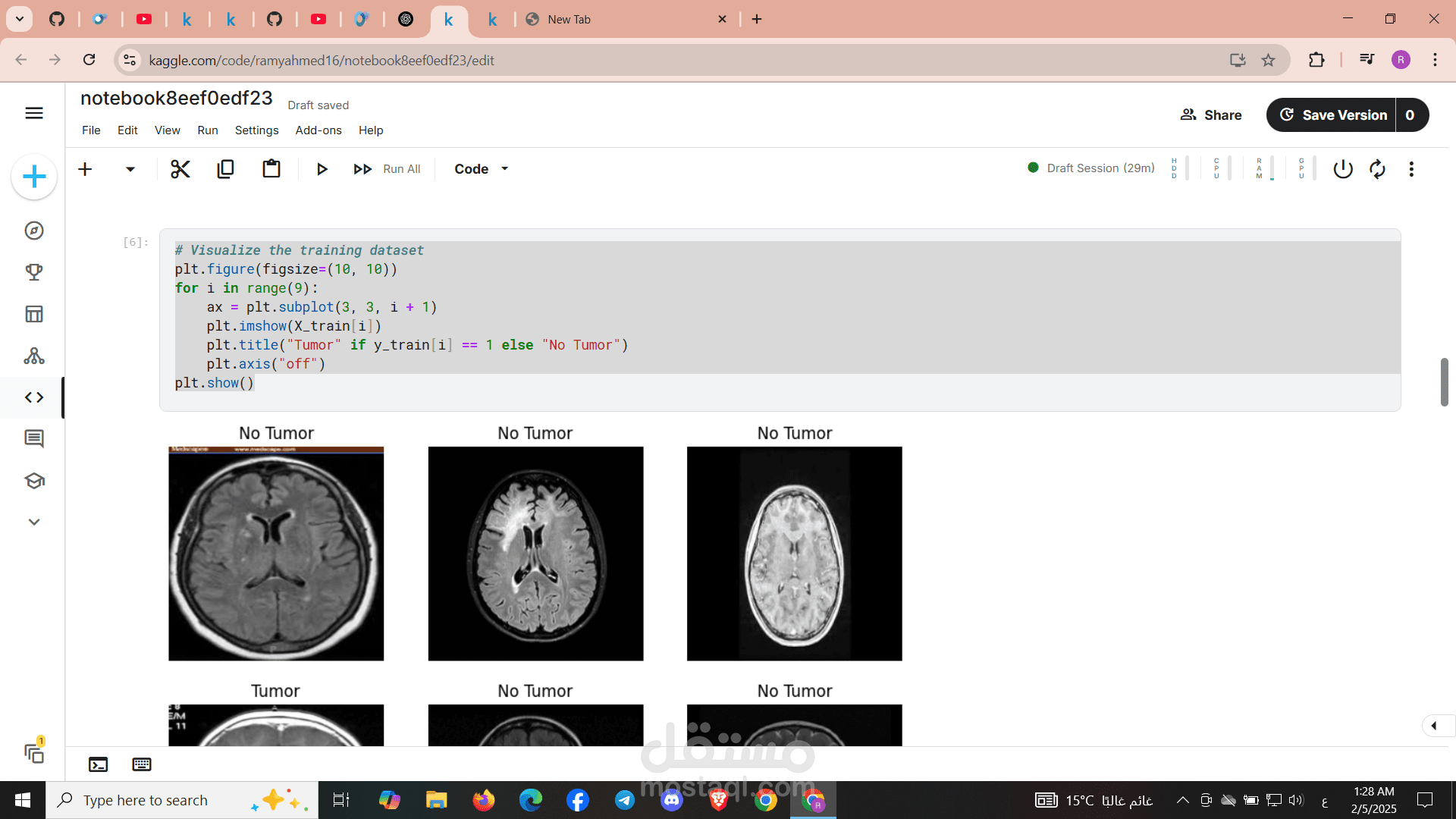 Tumor & non Tumor Brain