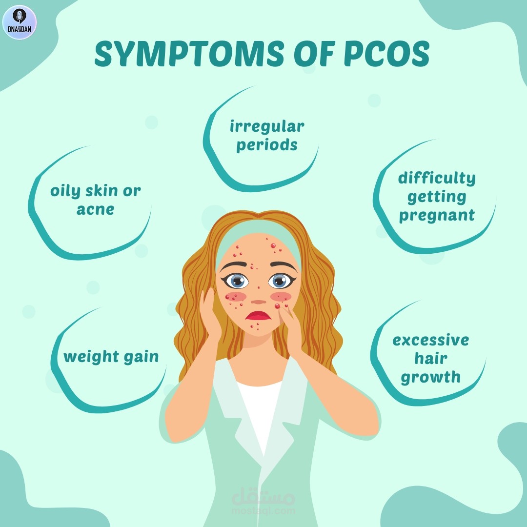 التوعية حول مرض PCOS