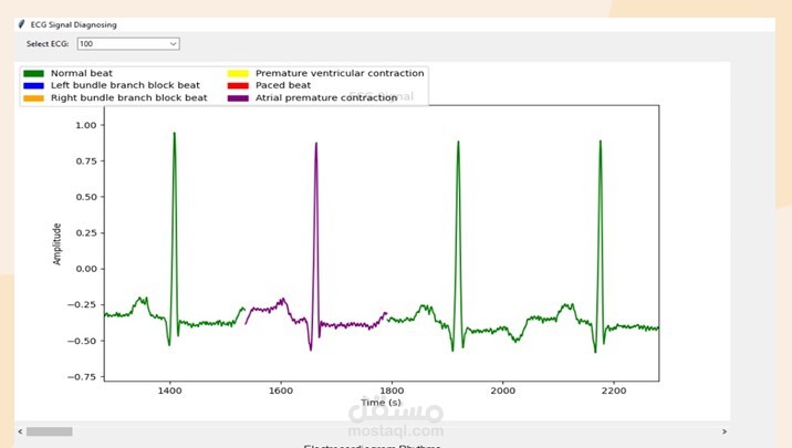 نظام ذكي لاكتشاف أمراض القلب من إشارات تخطيط القلب (ECG) باستخدام الذكاء الاصطناعي