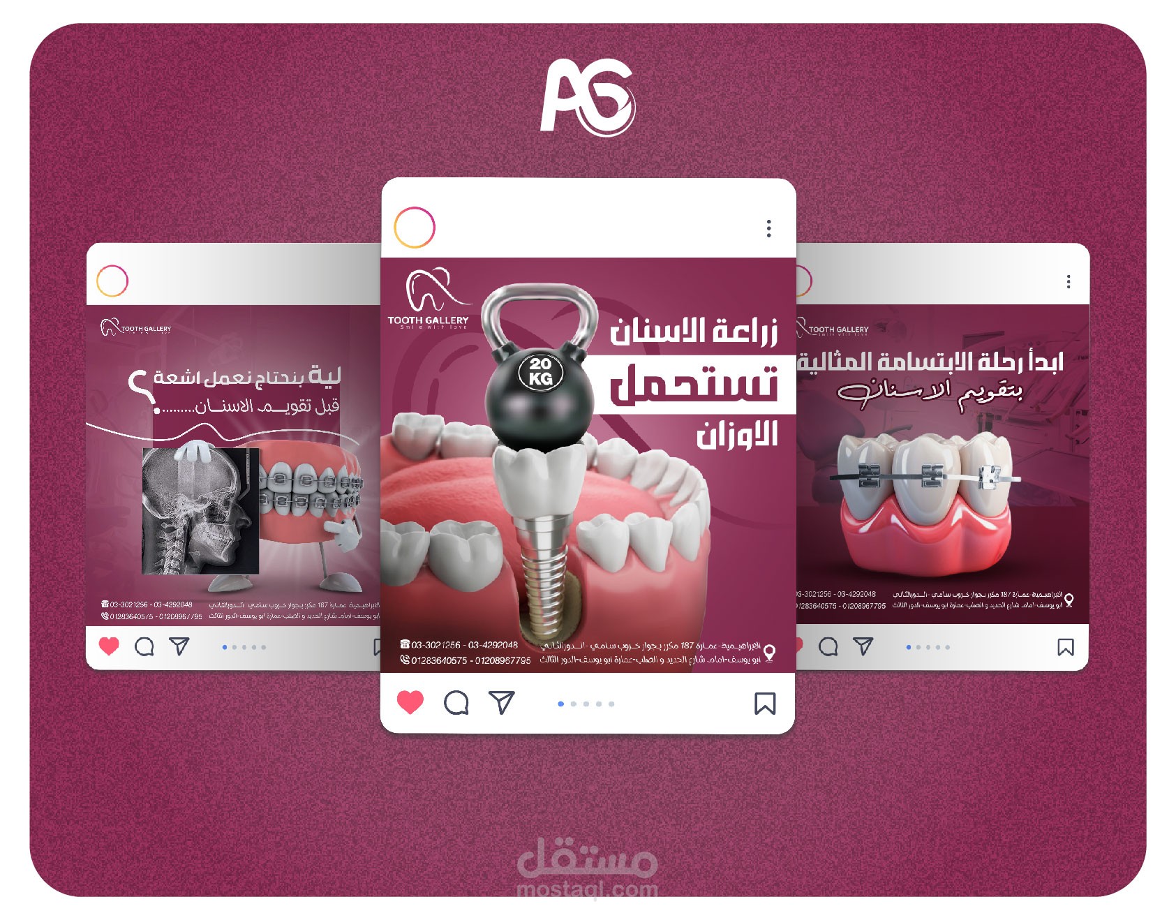 تصميمات سوشيال ميديا لمركز اسنان