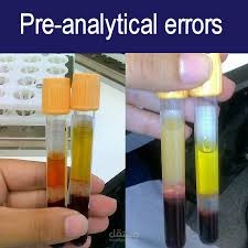 pre-analytical laboratory errors
