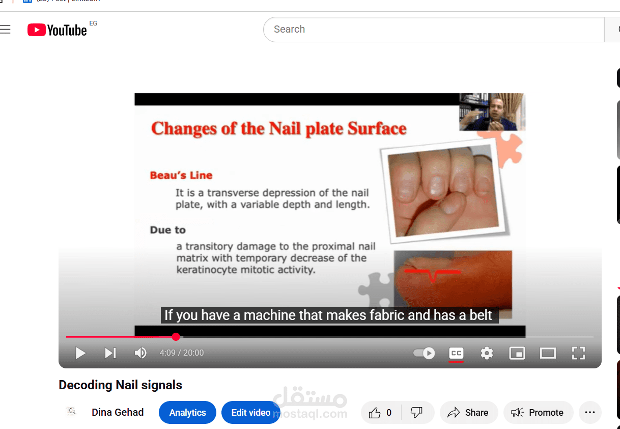 ترجمة احترافية لفيديو طبي: Decoding Nail Signals