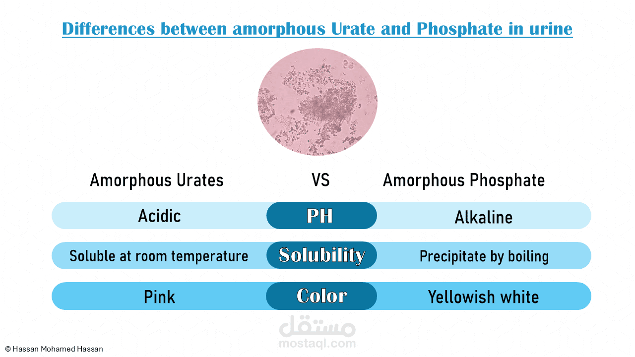 Urine examination