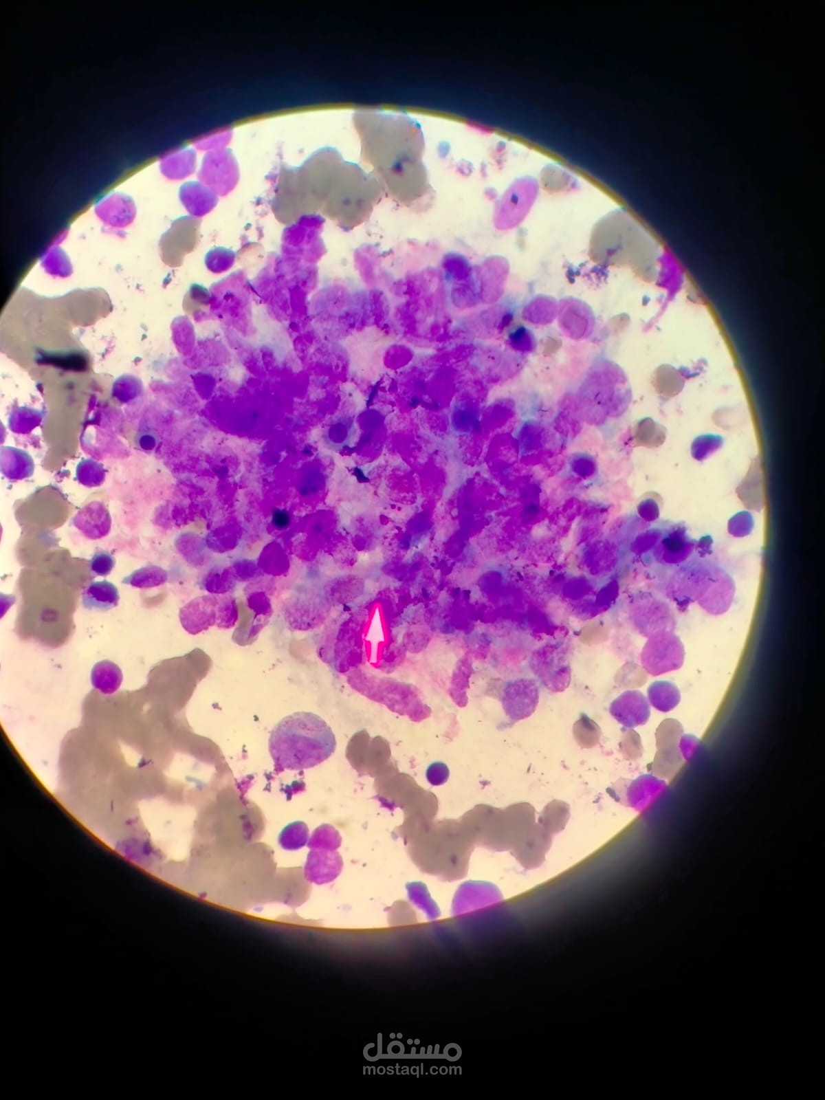 Introduction to clinical pathology