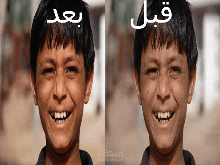 تعديل الطفل