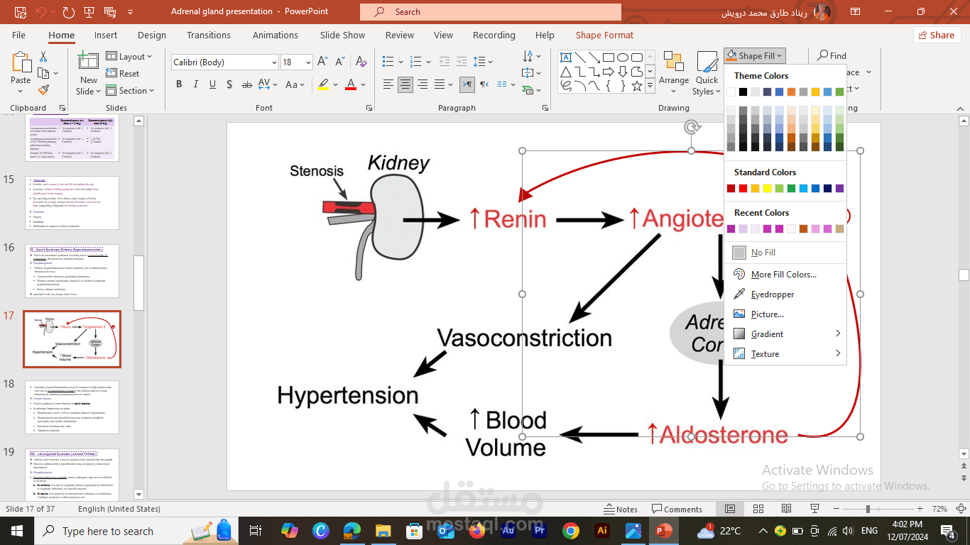 عرض تقديمي احترافي حول اضطرابات الغدة الكظرية باستخدام PowerPoint