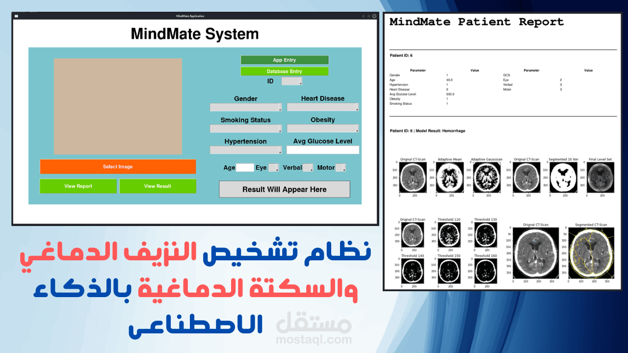 نظام تشخيص النزيف الدماغي والسكتة الدماغية بالذكاء الاصطناعى