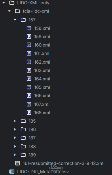 Master’s Project: Reproducible Pulmonary Nodule Segmentation on LIDCIDRI: