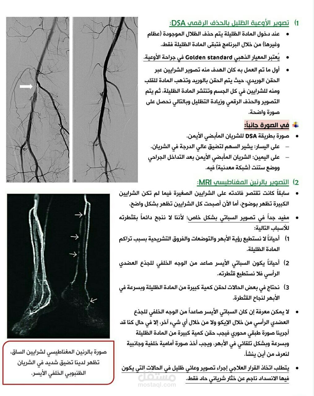 محاضرة لطلاب الطب البشري بعنوان الأنسداد الشرياني الحاد