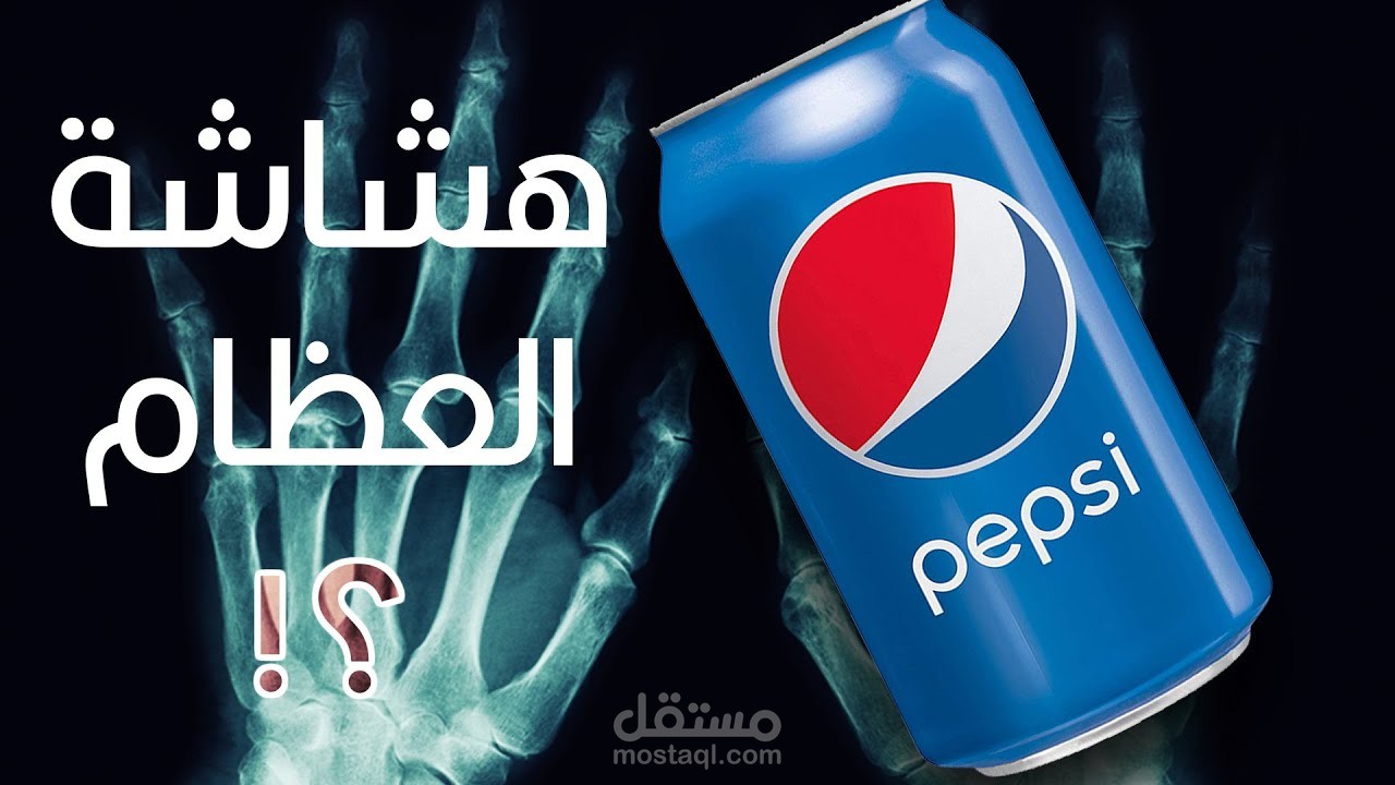 هل البيبسي بيسبب هشاشة العظام؟