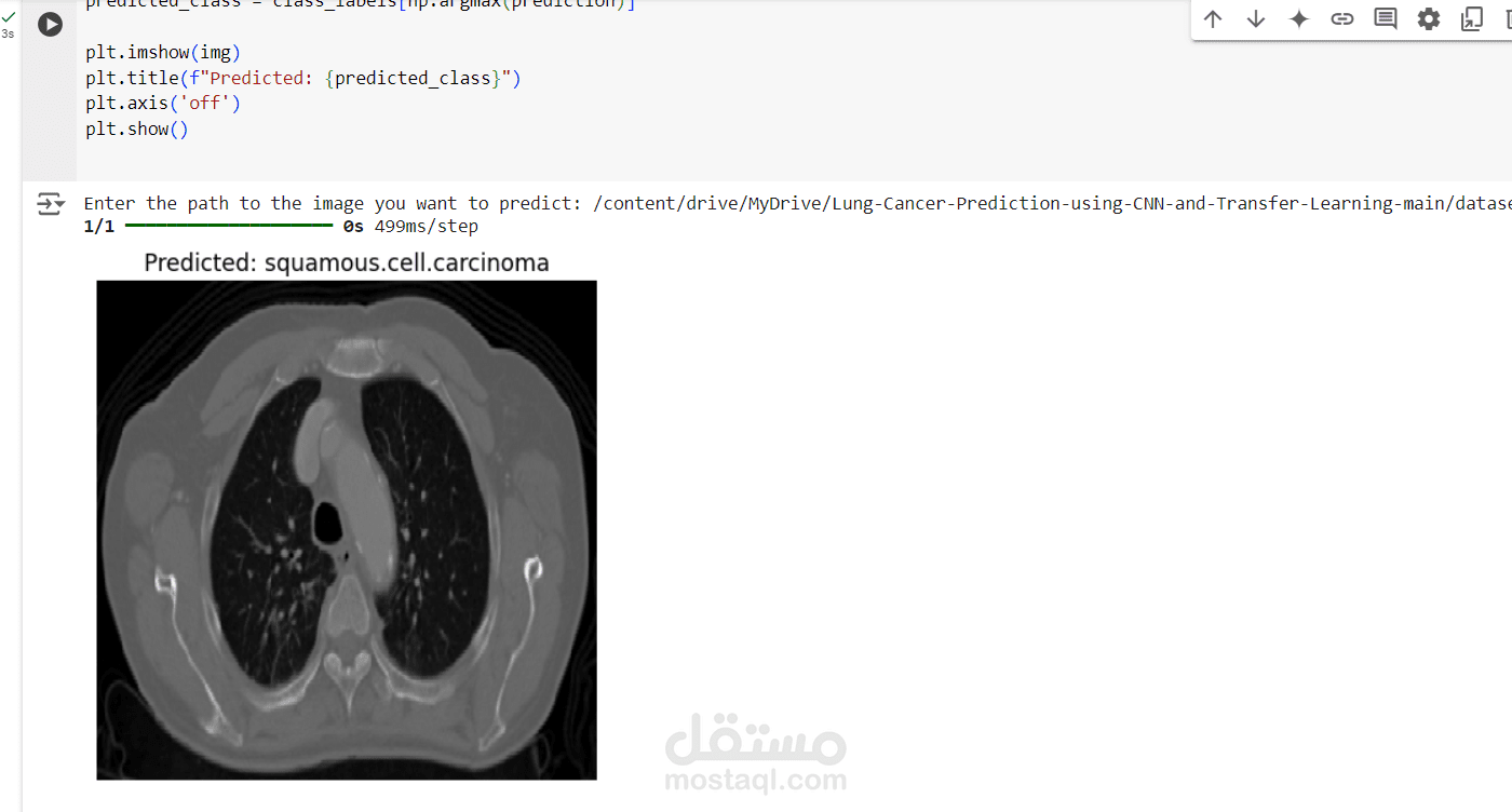 كشف عن سرطان الرئة باستخدام الشبكات العصبية الالتفافية