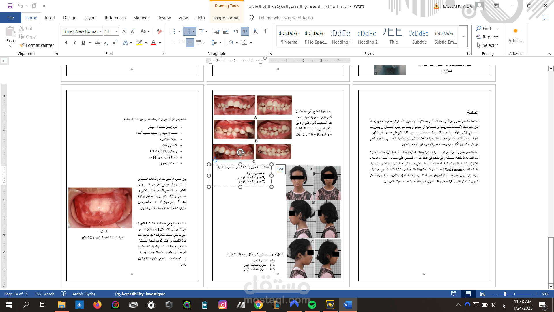بحث علمي (مع عرض تقديمي) أعد لنيل درجة البكلوريوس في طب و جراحة الأسنان