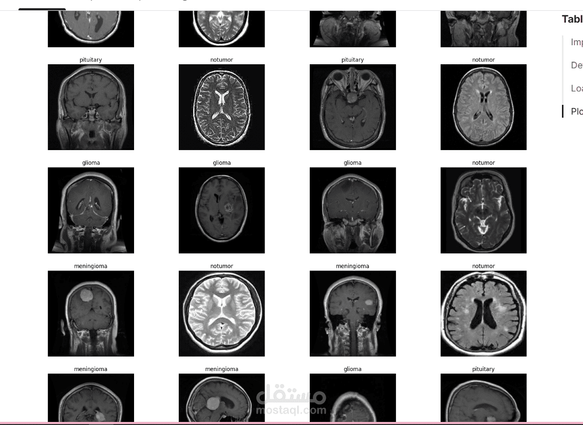 تصنيف أورام الدماغ باستخدام التعلم الانتقالي ونموذج VGG16