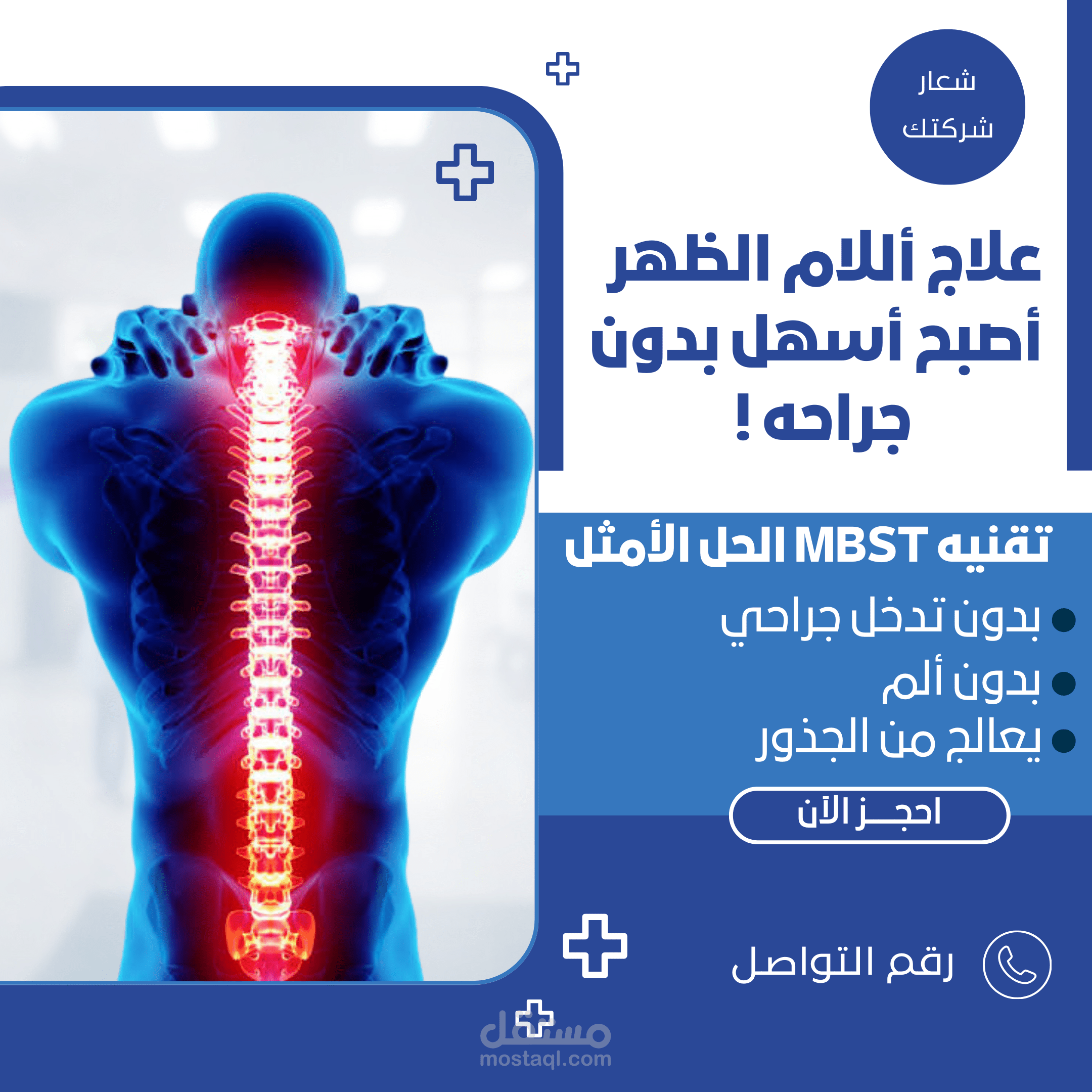 "تقنية MBST لعلاج مشاكل العظام: حلول طبية مبتكرة"