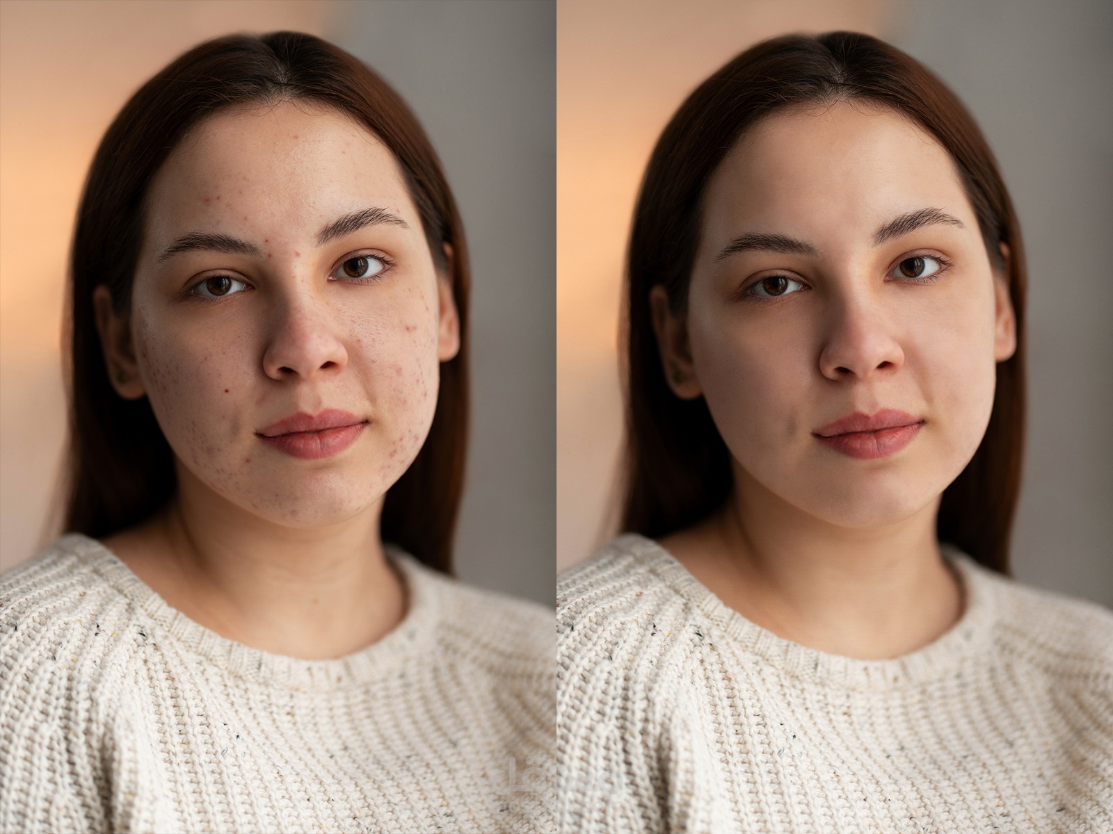 تنقيح وتنعيم البشرة