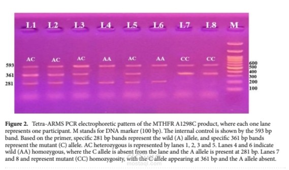 Association study between genetic  polymorphisms in MTHFR  and stroke susceptibility  in Egyptian population:  a case–control study
