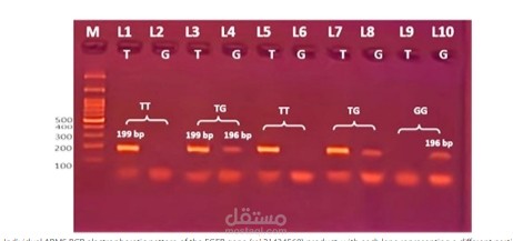Detection of EGFR gene polymorphisms  in non‑small cell lung cancer Egyptian patients:  a case–control stud