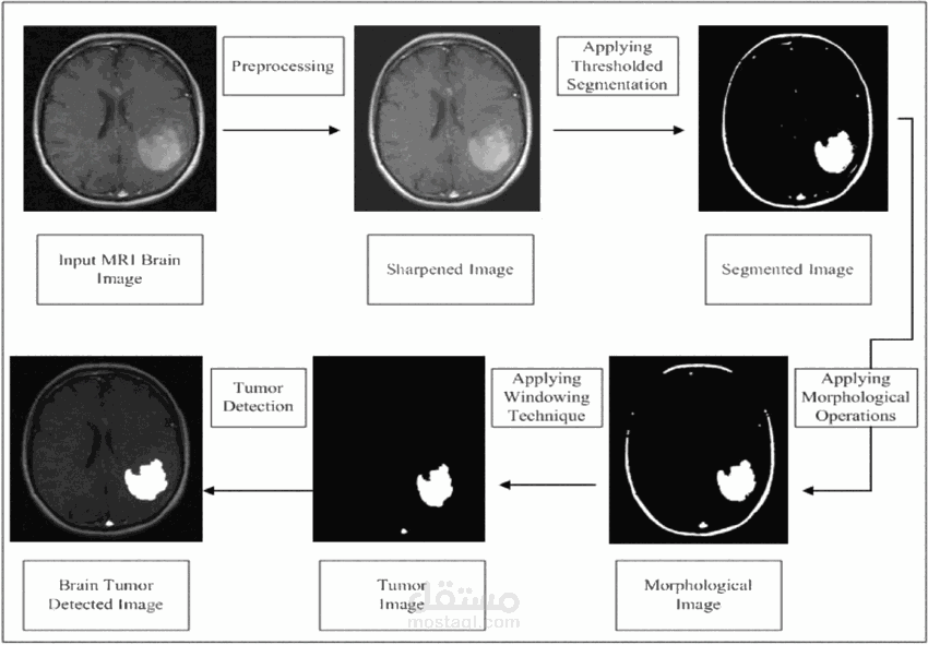 brain tumor detection