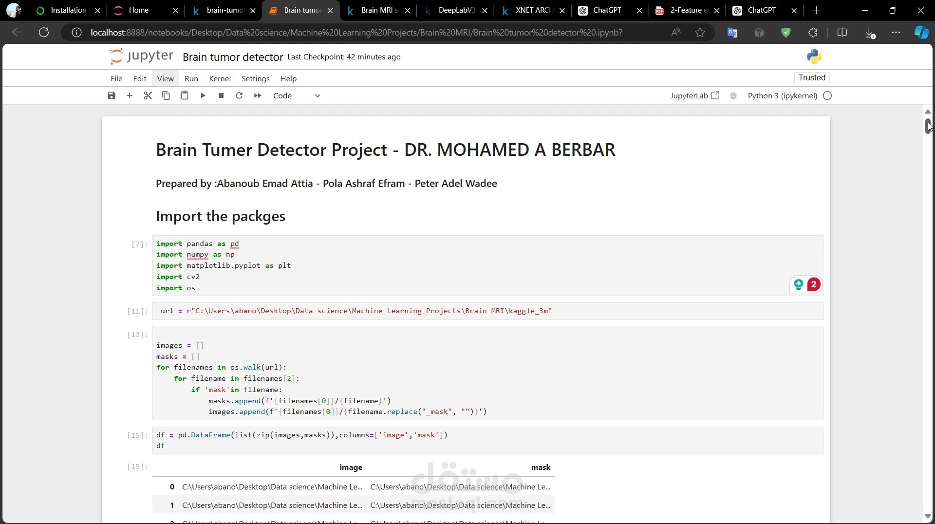 Brain tumor detector